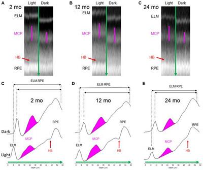Do multiple physiological OCT biomarkers indicate age-related decline in rod mitochondrial function in C57BL/6J mice?